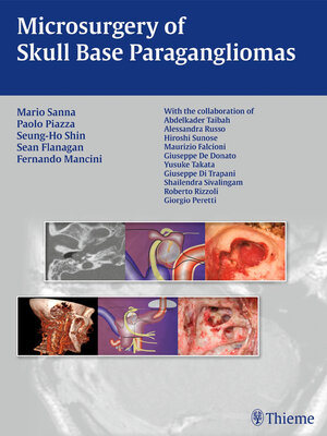 cover image of Microsurgery of Skull Base Paragangliomas